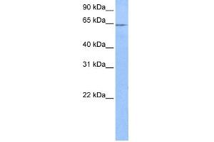 WB Suggested Anti-FAM71A Antibody Titration: 0. (FAM71A anticorps  (C-Term))