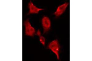 ABIN6269045 staining HeLa by IF/ICC. (CHEK1 anticorps  (Internal Region))