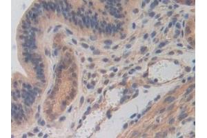 Detection of CDH16 in Mouse Uterus Tissue using Polyclonal Antibody to Cadherin 16 (CDH16)