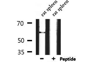 Western blot analysis of extracts from rat spleen, using Phospho-HDAC2 (Ser394) Antibody.