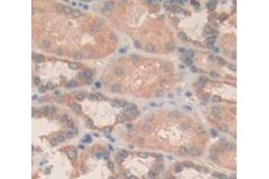 Figure. (NAGA anticorps  (AA 18-217))