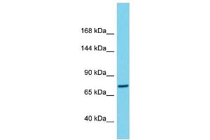 Western Blotting (WB) image for anti-Chromosome 1 Open Reading Frame 112 (C1ORF112) (C-Term) antibody (ABIN2791131) (C1orf112 anticorps  (C-Term))