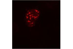 Fig. (DDDDK Tag anticorps)