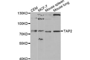 Western blot analysis of extracts of various cell lines, using TAP2 antibody (ABIN5970782) at 1/1000 dilution. (TAP2 anticorps)