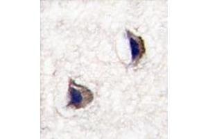 Formalin-fixed and paraffin-embedded human brain tissue reacted with NP1 (Nptx1) Antibody (Center) , which was peroxidase-conjugated to the secondary antibody, followed by DAB staining.