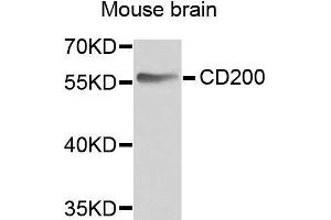 Western blot analysis of extracts of various cell lines, using CD200 antibody. (CD200 anticorps  (AA 30-240))