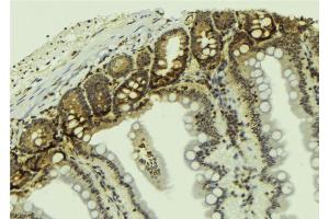 ABIN6267585 at 1/100 staining Mouse colon tissue by IHC-P.