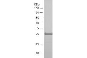 Western Blotting (WB) image for Mannosidase, beta A, Lysosomal-Like (MANBAL) (AA 45-85) protein (His-IF2DI Tag) (ABIN7123845) (MANBAL Protein (AA 45-85) (His-IF2DI Tag))