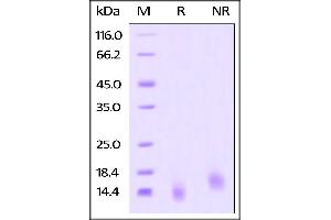 Human BCMA, His Tag on SDS-PAGE under reducing (R) and no-reducing (NR) conditions.
