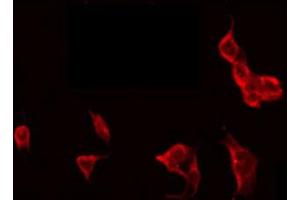 ABIN6272285 staining HT29 by IF/ICC.