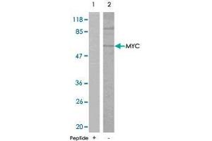 Western blot analysis of extracts from ovary cancer cells , using MYC polyclonal antibody  . (c-MYC anticorps)