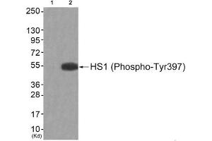 Western blot analysis of extracts from JK cells (Lane 2), using HS1 (Phospho-Tyr397) Antibody. (HCLS1 anticorps  (pTyr397))