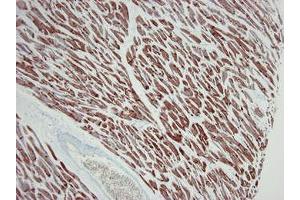 Image no. 3 for anti-Actin, Alpha, Cardiac Muscle 1 (ACTC1) antibody (ABIN959519)