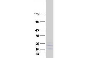 Validation with Western Blot
