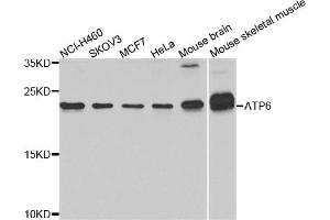 Western blot analysis of extracts of various cell lines, using ATP6 antibody (ABIN5975827) at 1/1000 dilution. (MT-ATP6 anticorps)