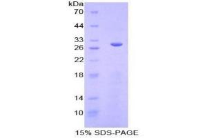 SDS-PAGE analysis of Mouse SGK3 Protein. (SGK3 Protéine)