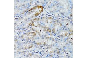 Immunohistochemistry of paraffin-embedded rat kidney using MOAP1 antibody (ABIN6290585) at dilution of 1:100 (40x lens).