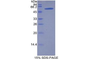 SDS-PAGE analysis of Mouse Lipase, Hepatic Protein. (LIPC Protéine)