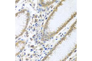 Immunohistochemistry of paraffin-embedded human stomach using EIF4E antibody at dilution of 1:100 (40x lens). (EIF4E anticorps)