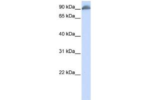 WB Suggested Anti-EPB41 Antibody Titration:  0. (EPB41 anticorps  (N-Term))