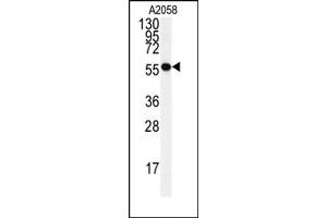 Image no. 1 for anti-Heat Shock 60kDa Protein 1 (Chaperonin) (HSPD1) (Center) antibody (ABIN358040) (HSPD1 anticorps  (Center))