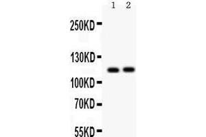Anti- ATP2A2 antibody, Western blotting All lanes: Anti ATP2A2  at 0.