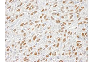 Immunohistochemistry (IHC) image for anti-Structural Maintenance of Chromosomes 1A (SMC1A) (C-Term) antibody (ABIN7448802) (SMC1A anticorps  (C-Term))