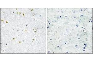 Immunohistochemistry analysis of paraffin-embedded human brain tissue, using TRIM24 Antibody.