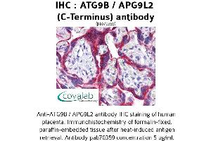 Image no. 1 for anti-Autophagy Related 9B (ATG9B) (C-Term) antibody (ABIN1732024) (ATG9B anticorps  (C-Term))
