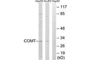 Western blot analysis of extracts from HuvEc/HepG2 cells, using COMT Antibody. (COMT anticorps  (AA 61-110))
