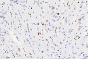 Immunohistochemistry analysis of paraffin-embedded mouse heart using,SET (ABIN7075583) at dilution of 1: 10000