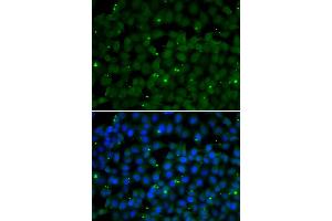 Immunofluorescence analysis of U2OS cells using GPI antibody (ABIN6292114). (GPI anticorps)
