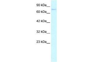 WB Suggested Anti-ZNF336 Antibody Titration: 0. (ZNF336 anticorps  (N-Term))