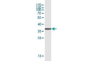 Western Blot detection against Immunogen (37.
