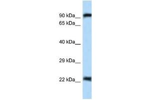 WB Suggested Anti-Uhrf2 Antibody Titration: 1. (UHRF2 anticorps  (N-Term))