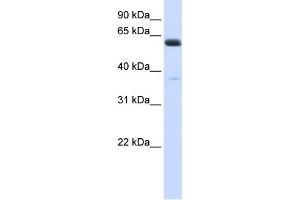 WB Suggested Anti-ALG6 Antibody Titration:  0. (ALG6 anticorps  (N-Term))