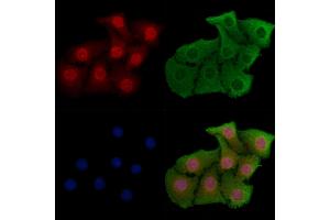 ABIN6256993 and ABIN6274555 staining Hela cells by IF/ICC.