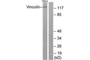Western blot analysis of extracts from HeLa cells, treated with forskolin 40nM 30', using Vinculin (Ab-821) Antibody.
