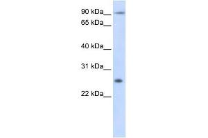 Tetraspanin 31 antibody used at 1 ug/ml to detect target protein. (TSPAN31 anticorps  (Middle Region))