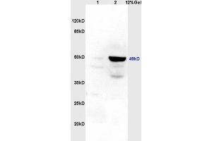 Lane 1: rat brain lysates Lane 2: rat heart lysates probed with Anti Legumain Polyclonal Antibody, Unconjugated (ABIN750958) at 1:200 in 4 °C.