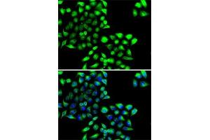 Immunofluorescence analysis of MCF7 cells using COPS6 antibody (ABIN6130710, ABIN6138885, ABIN6138886 and ABIN6222868). (COPS6 anticorps  (AA 58-327))