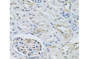 Immunohistochemistry of paraffin-embedded Rat kidney using SLC29A1 Polyclonal Antibody at dilution of 1:100 (40x lens). (SLC29A1 anticorps)