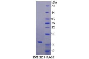 SDS-PAGE analysis of Human S100A15 Protein. (S100A7A Protéine)