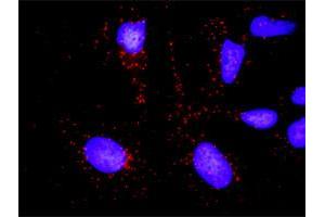 Proximity Ligation Analysis of protein-protein interactions between KLK3 and A2M.