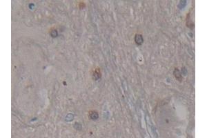 DAB staining on IHC-P; Samples: Rat Spinal cord Tissue (CDNF anticorps  (AA 20-183))