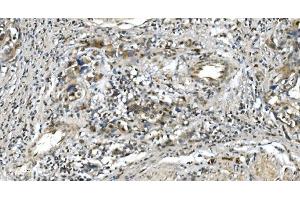 IHC analysis of LSM5 using anti-LSM5 antibody (ABIN7602503).
