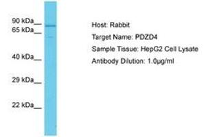 Image no. 1 for anti-PDZ Domain Containing 4 (PDZD4) (AA 536-585) antibody (ABIN6750650) (PDZD4 anticorps  (AA 536-585))