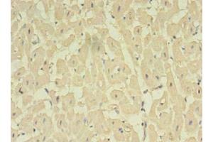 Immunohistochemistry of paraffin-embedded human heart tissue using ABIN7161713 at dilution of 1:100 (NOSTRIN anticorps  (AA 1-322))