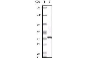 Western Blot showing calcyclin antibody used against truncated calcyclin recombinant protein.