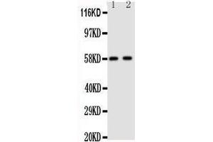 Anti-Aromatase antibody, Western blotting Lane 1: Human Placenta Tissue Lysate Lane 2: Human Placenta Tissue Lysate (Aromatase anticorps  (C-Term))